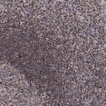 SMCHD1 Antibody in Immunohistochemistry (Paraffin) (IHC (P))