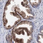 MED13L Antibody in Immunohistochemistry (Paraffin) (IHC (P))