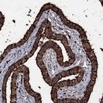 OGFOD2 Polyclonal Antibody