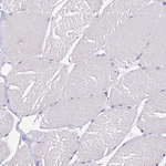 FAM155A Antibody in Immunohistochemistry (Paraffin) (IHC (P))