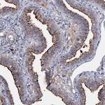 MANSC4 Polyclonal Antibody