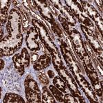 DHDPSL Polyclonal Antibody