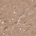 PLEKHM1 Antibody in Immunohistochemistry (Paraffin) (IHC (P))