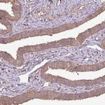 PLEKHM1 Antibody in Immunohistochemistry (Paraffin) (IHC (P))
