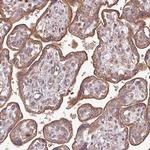 PLEKHM1 Antibody in Immunohistochemistry (Paraffin) (IHC (P))