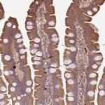 PLEKHM1 Antibody in Immunohistochemistry (Paraffin) (IHC (P))