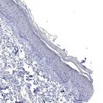 NALP14 Antibody in Immunohistochemistry (Paraffin) (IHC (P))