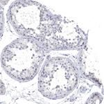 NALP14 Antibody in Immunohistochemistry (Paraffin) (IHC (P))