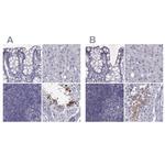 FAM71B Polyclonal Antibody