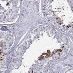 FAM71B Antibody in Immunohistochemistry (IHC)