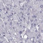 FAM71B Antibody in Immunohistochemistry (IHC)