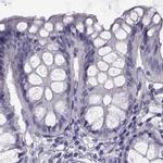 FAM71B Antibody in Immunohistochemistry (IHC)