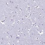 EHBP1L1 Antibody in Immunohistochemistry (Paraffin) (IHC (P))