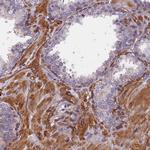 EHBP1L1 Antibody in Immunohistochemistry (Paraffin) (IHC (P))
