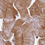 EHBP1L1 Antibody in Immunohistochemistry (Paraffin) (IHC (P))