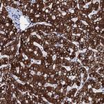 GYS2 Polyclonal Antibody