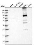 GYS2 Antibody in Western Blot (WB)