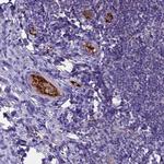TCP11L2 Antibody in Immunohistochemistry (Paraffin) (IHC (P))