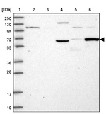 TCP11L2 Antibody in Western Blot (WB)