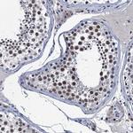 FNBP4 Antibody in Immunohistochemistry (IHC)