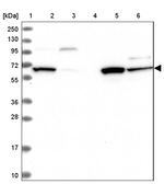 DAK Antibody in Western Blot (WB)