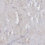 ANKRD13A Antibody in Immunohistochemistry (IHC)