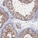 ANKRD13A Antibody in Immunohistochemistry (IHC)
