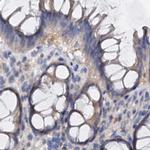 ANKRD13A Antibody in Immunohistochemistry (IHC)