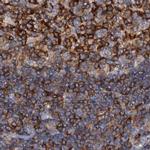 ANKRD13A Antibody in Immunohistochemistry (IHC)