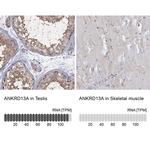 ANKRD13A Antibody