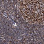 ANKRD13A Antibody in Immunohistochemistry (IHC)