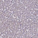 NCKAP1L Antibody in Immunohistochemistry (Paraffin) (IHC (P))