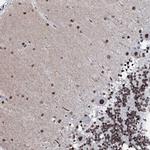 C11orf57 Polyclonal Antibody