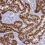 GLYATL1 Polyclonal Antibody