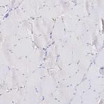 GLYATL1 Antibody in Immunohistochemistry (Paraffin) (IHC (P))