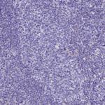 GLYATL1 Antibody in Immunohistochemistry (Paraffin) (IHC (P))