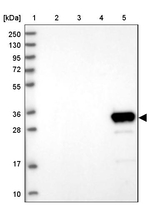 GLYATL1 Antibody in Western Blot (WB)
