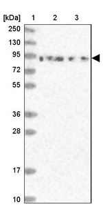 DDX51 Antibody in Western Blot (WB)