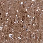 FBXL16 Antibody in Immunohistochemistry (Paraffin) (IHC (P))