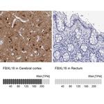 FBXL16 Antibody in Immunohistochemistry (IHC)