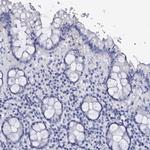 FBXL16 Antibody in Immunohistochemistry (IHC)