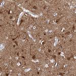 FBXL16 Antibody in Immunohistochemistry (IHC)