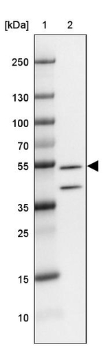 FBXL16 Antibody in Western Blot (WB)