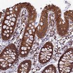 SPR Antibody in Immunohistochemistry (Paraffin) (IHC (P))