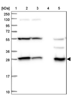 SPR Antibody in Western Blot (WB)