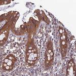 WDR24 Polyclonal Antibody