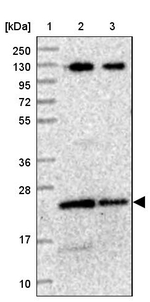 LOH12CR1 Antibody in Western Blot (WB)