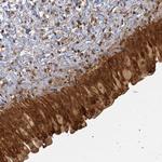ZNF549 Antibody in Immunohistochemistry (Paraffin) (IHC (P))