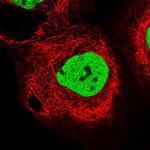 PDS5B Polyclonal Antibody