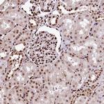 PDS5B Antibody in Immunohistochemistry (Paraffin) (IHC (P))